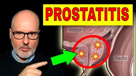 prostatitis aguda y crÓnica síntomas causas y tratamiento youtube