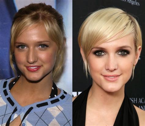 Nose Job Before And After Ashlee Simpson Nose Job