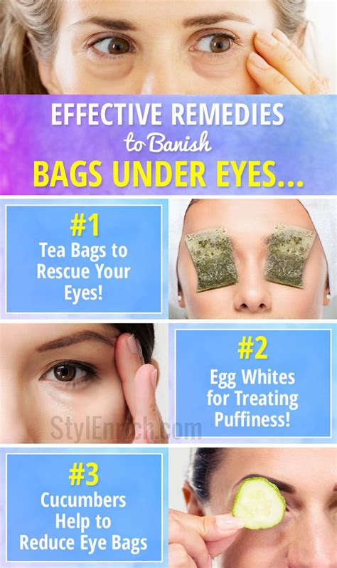 How To Get Rid Of Eye Bags Effective Remedies To Banish Puffy Eyes