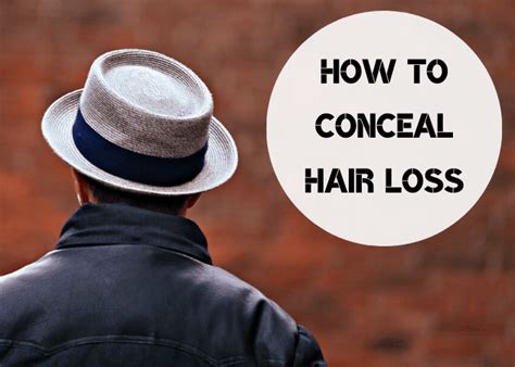 9 Ways To Cover Up Your Hair Loss If Nothing Else Works