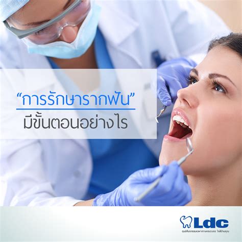 การรักษารากฟัน คืออะไร ? - LDC