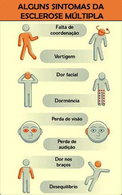 A esclerose múltipla é uma doença crónica, inflamatória e degenerativa, que afeta o sistema nervoso central e que surge entre os 20 e os 40 anos de idade. Blogão de Fisio: ESCLEROSE MÚLTIPLA (EM)