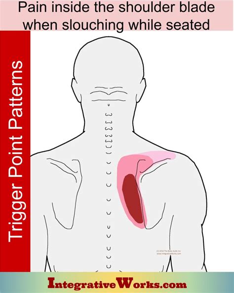 Pain Between Shoulder Blades When Slouching Integrative Works