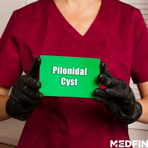 What Is Pilonidal Sinus Causes And Symptoms Medfin