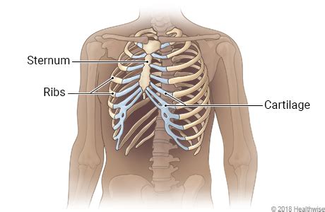 The ribs and the hand are not on a limb together, so they cannot be described in relation to each other using proximal and distal. Fractured Rib - Fixio