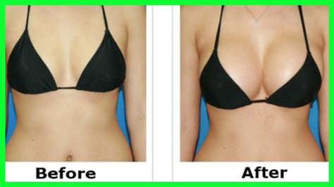 Lift Tighten Prevent Sagging Breasts Firm Sagging Breasts Naturally With Effective Home