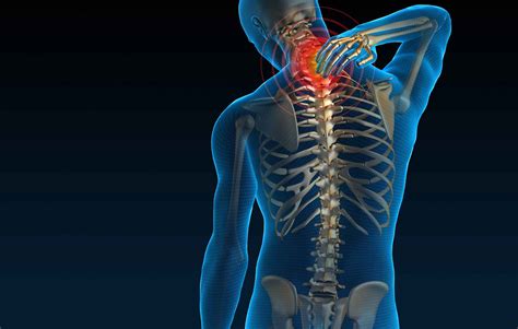 Upper Back Pain Disc Spine Institute Tx