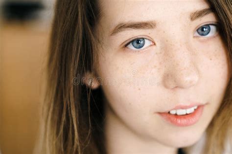 Freckle Portrait Of Young Cute Girl With Blue Eyes Stock Photo Image