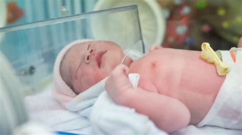 Steroids Protect Preemies Brains Stanford Study Finds Scope