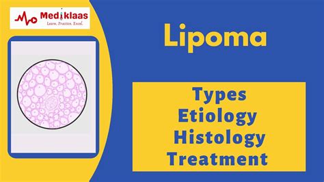 Lipoma Types Etiology Histology And Treatment L General Surgery L