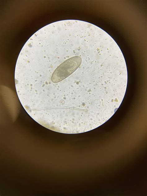 Nematode Egg Rparasitology