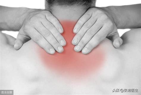肺癌會出現一側肩背部疼痛嗎？以下情況需要鑑別 每日頭條
