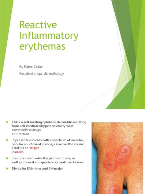 Reactive Inflammatory Erythemas Pdf Inflammation Monocyte