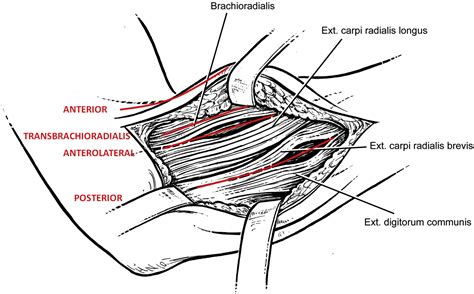 References In Anatomical Study Of The Surgical Approaches To The Radial
