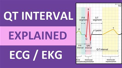 Qt Interval Explained Ecg Ekg Interpretation Nursing Nclex Youtube