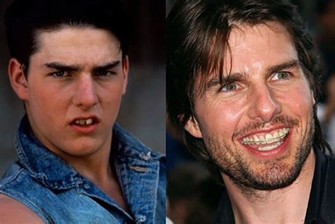 Tom Cruise Middle Teeth What S Happened To Tom Cruise S Teeth Maximus Rogahn