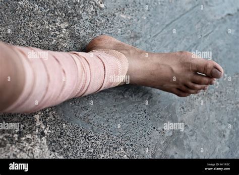 Human Leg Covered With A Bandage Or Plaster Stock Photo Alamy