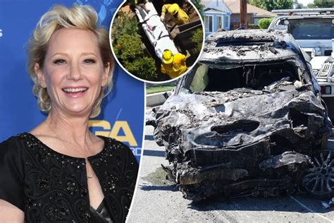 Actress Anne Heche Severely Burned In Fiery Car Crash Video