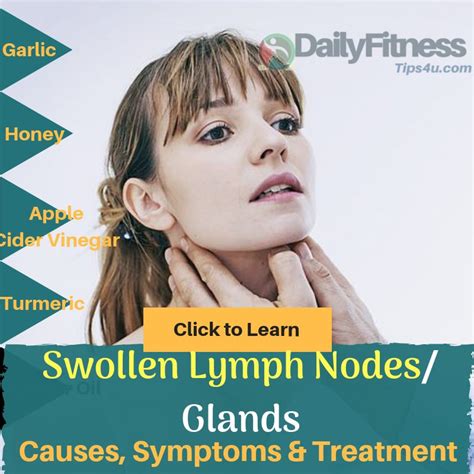 Swollen Lymph Nodes And Glands Causes Picture Symptoms Treatment