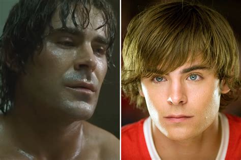 Zac Efron Plastic Surgery Before And After Jaw Dropping Transformations