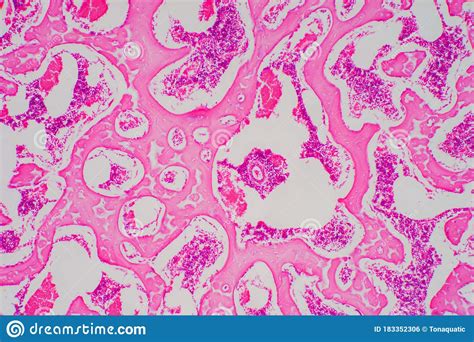 Human Hyaline Cartilage Bone Under Microscope View For Education Stock