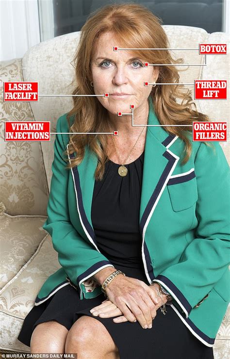 duchess of york finally confesses to cosmetic tweaks over the years in gloriously candid detail