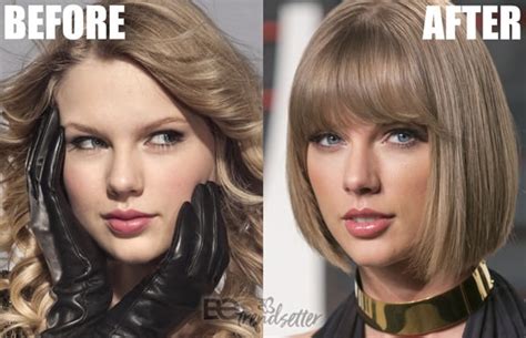 Taylor Swift Plastic Surgery Before And After Many People Are Lately