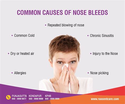 Common Causes Of Nose Bleeding Malayelly