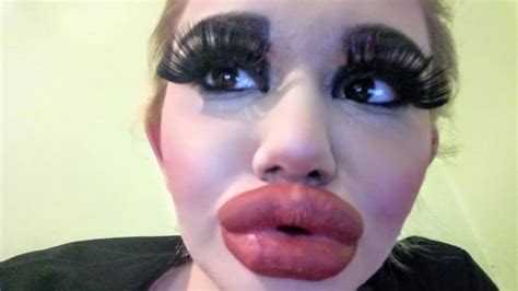 Andrea Ivanova Has Lip Injections To Look Like Idol Barbie News Au Australias