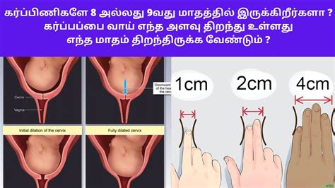 Cervix Length For Normal Delivery In Cm Cervix Length For Normal Delivery In Mm In Tamil Youtube