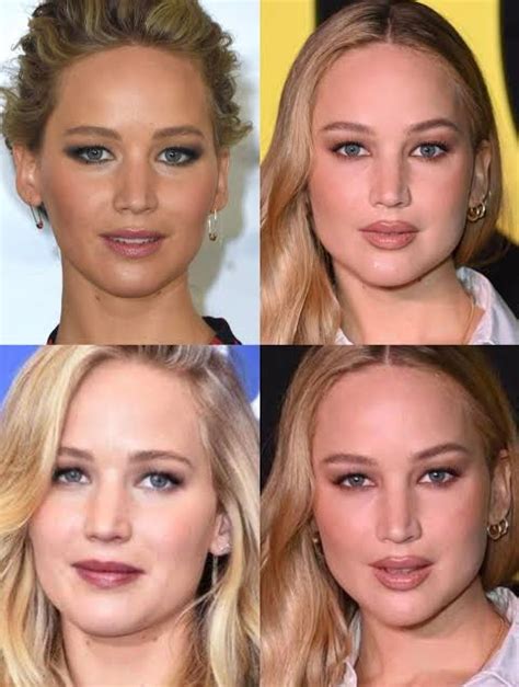 Jennifer Lawrence Hits Back At Speculation She Had Plastic Surgery On