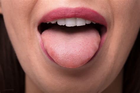 Natural Treatments And Home Remedies For Bump On Tongue How To Cure
