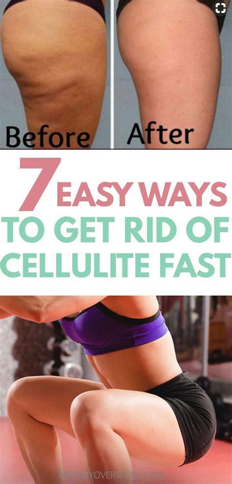 Pin On Most Effective Cellulite Removal