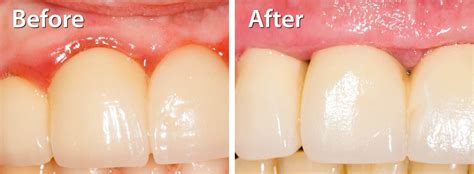 Nassau County Periodontist Dr Marichia Attalla Dds Pc