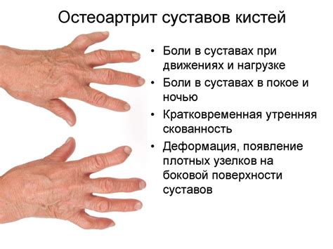 Болят и чешутся суставы на пальцах рук фото презентация