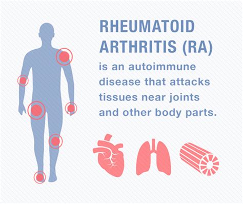 Rheumatoid Arthritis Myositis Support And Understanding