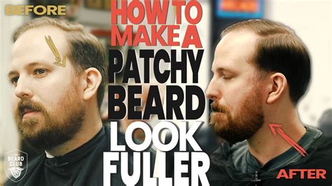 How To Make A Patchy Beard Look Fuller The Beard Club Youtube