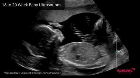 Your Baby At 20 Weeks With Ultrasound Youtube