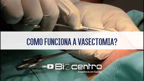 Como Funciona A Vasectomia Youtube