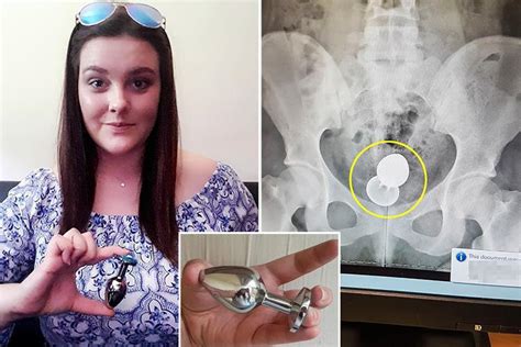 Woman Reveals How She Almost Needed A Colostomy Bag After Getting Four Inch Sex Toy Stuck Up Her