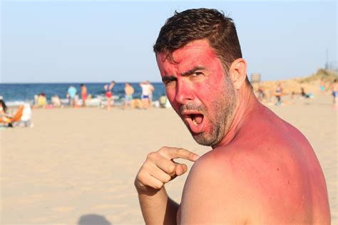 Man Getting Sunburned At The Beach Arizona Milk Producers
