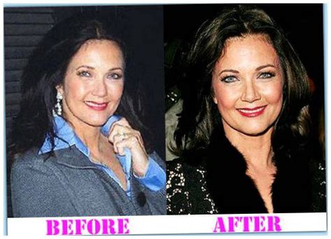 Lynda Carter Plastic Surgery Before And After Photos Celebrity