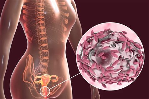 Vaginal Fluid Transplants To Begin In Hope They Will Cure Bacterial