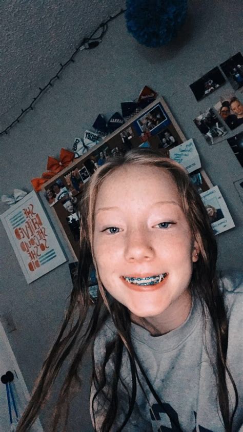 √ Light Blue Braces Color