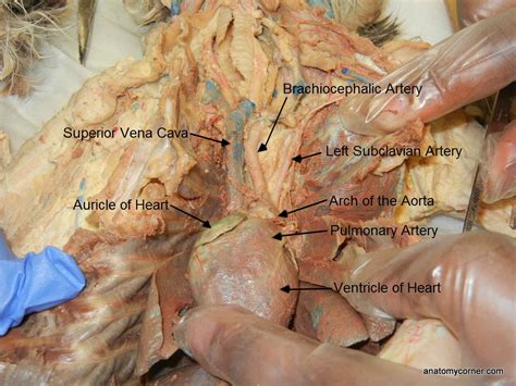 Blood may flow out of the body, as external bleeding, or it may flow into the spaces around. auricle_of_heart_L.jpg