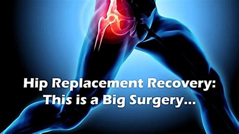 Hip Replacement Recovery What To Know And What To Expect