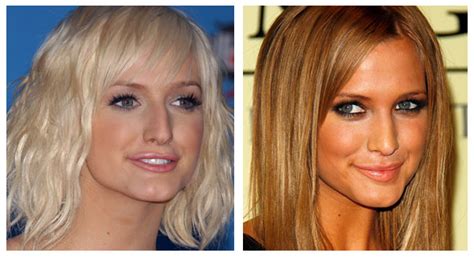 Plastic Surgery Before And After Ashlee Simpson Nose Job