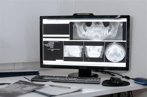 Radiografía Panorámica Y Tac Dental Conoce Las Diferencias