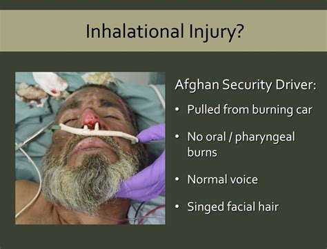 Does That Burn Casualty Need Intubation Crisis Medicine