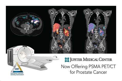 Jupiter Medical Center Targets Prostate Cancer With Psma Pet Ct Scans Florida Hospital News